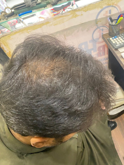 Before
